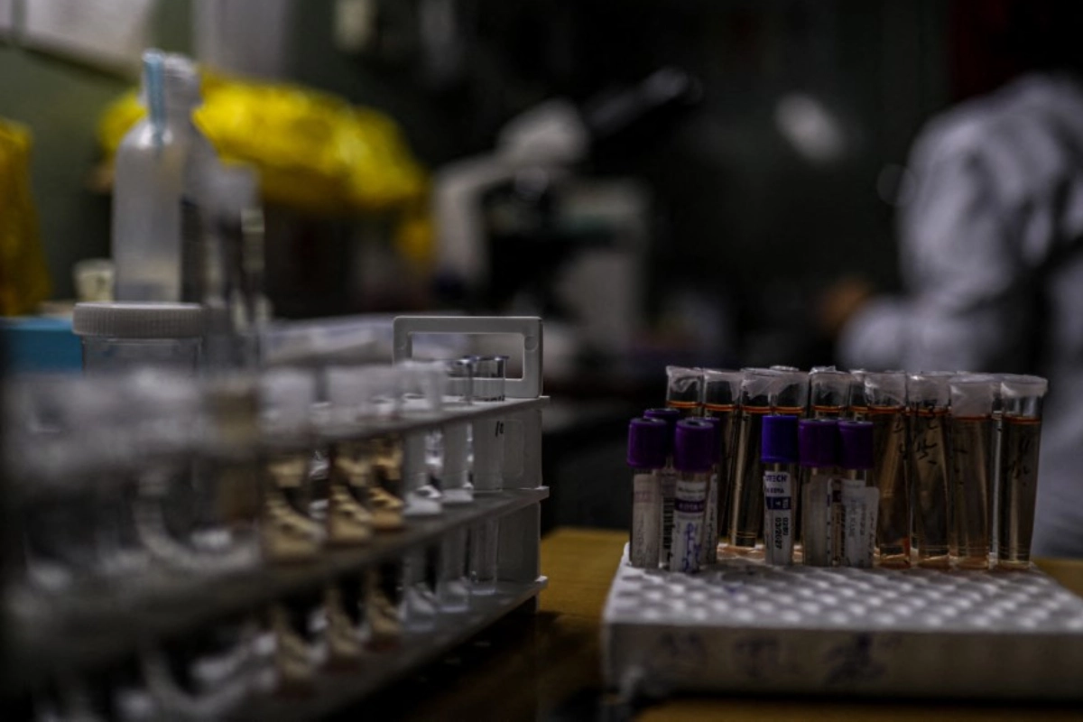 Muere investigadora tras liberación de "infección peligrosa" en laboratorio ruso | Grupo Animal